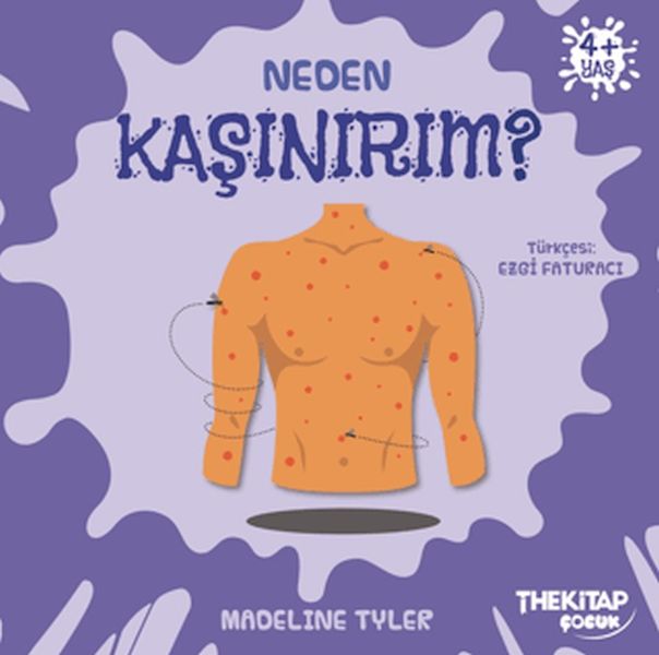 Neden Kaşınırım?